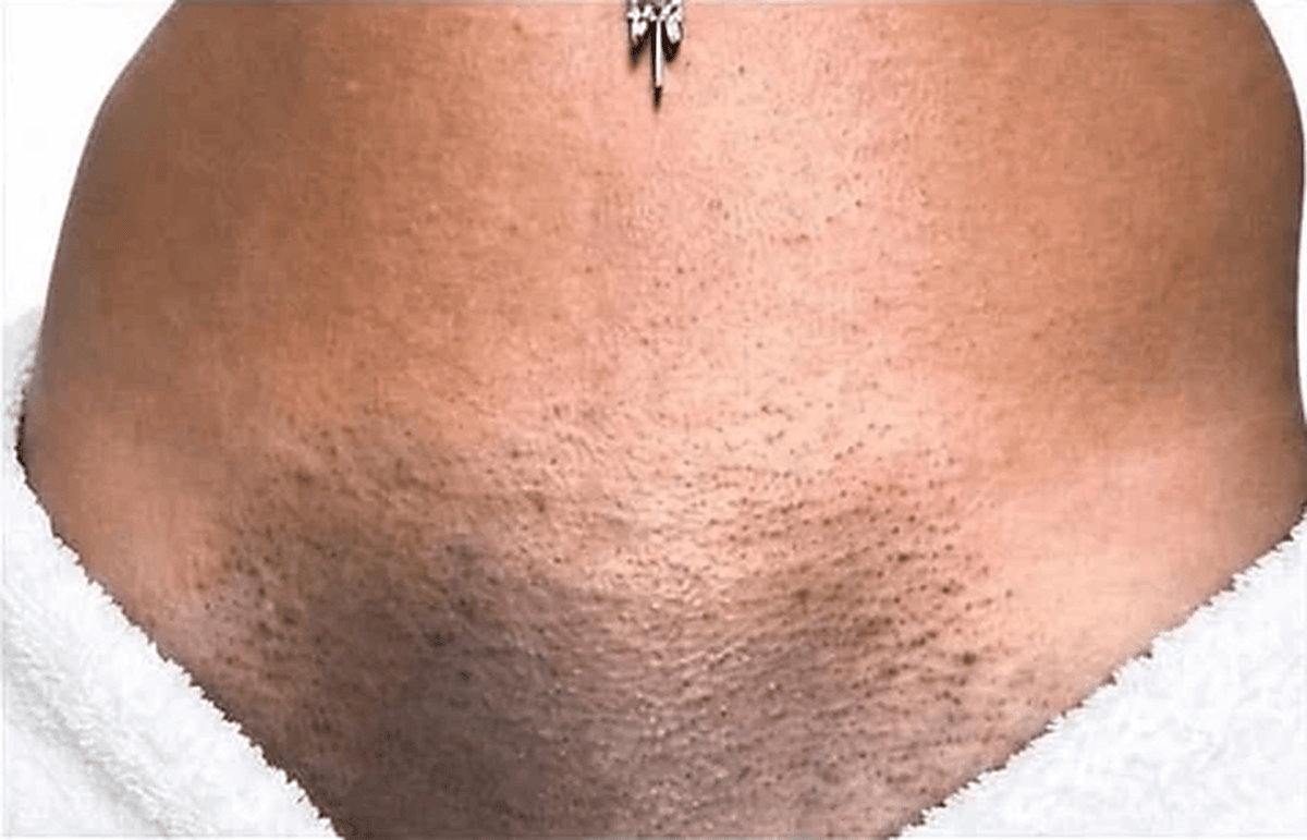 Before using Lutèce intimate balm