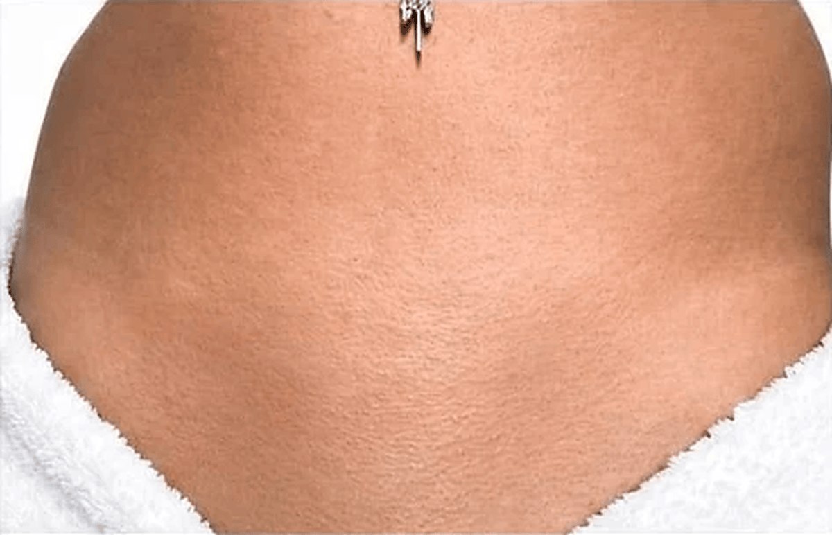 After using Lutèce intimate balm